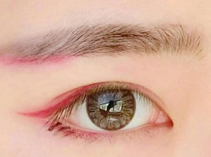 咸陽華爾醫(yī)療美容門診部激光去黑眼圈