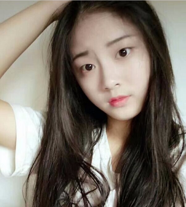 福州愛美爾整形黃林勝雙眼皮案例效果對(duì)比圖