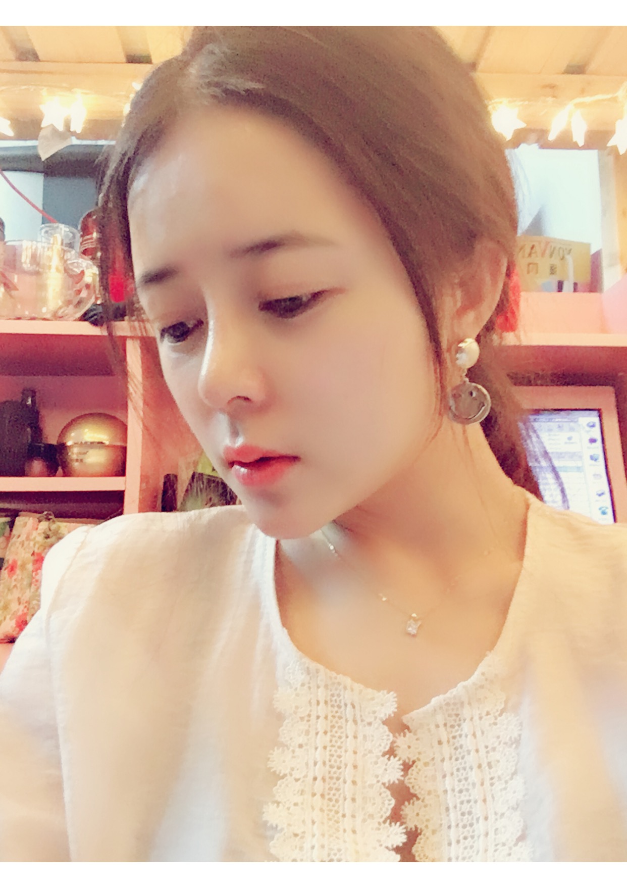 北京世濟(jì)周志強(qiáng)醫(yī)生鼻綜合案例