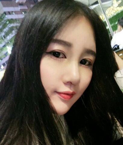 漢中韓美整形醫(yī)生常雙模假體隆鼻+耳軟骨墊鼻尖真實案例效果圖 漢中韓美整形醫(yī)生常雙模假體隆鼻+耳軟骨墊鼻尖真實案例效果圖