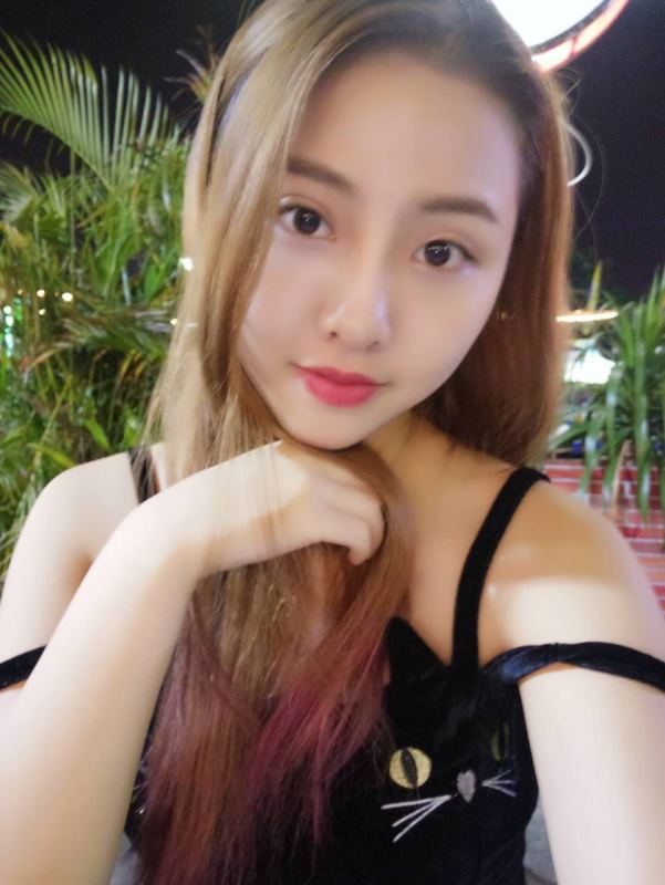 整形醫(yī)生徐長(zhǎng)亮做切開雙眼皮案例效果對(duì)比圖 整形醫(yī)生徐長(zhǎng)亮做切開雙眼皮案例效果對(duì)比圖