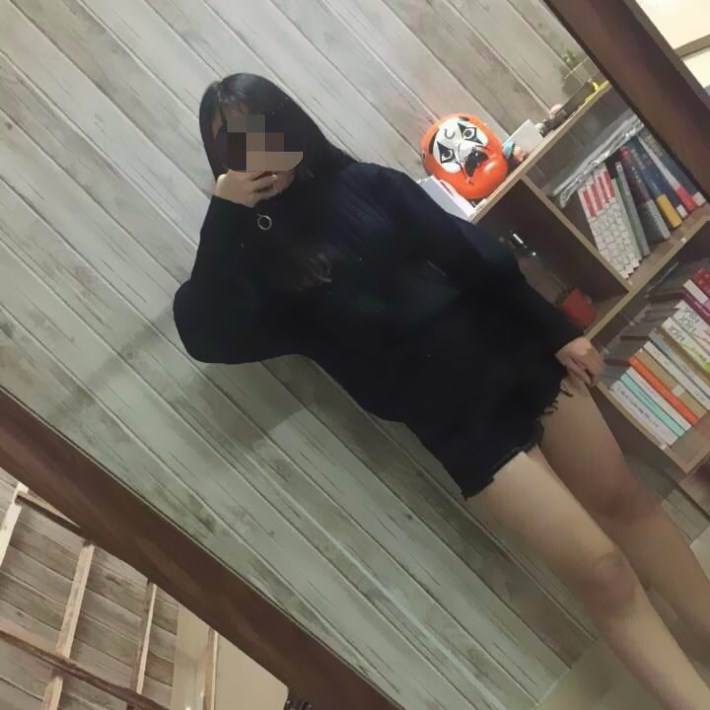 廣州軍頤醫(yī)院整形美容中心石建薇醫(yī)生腰腹吸脂真實案例對比圖