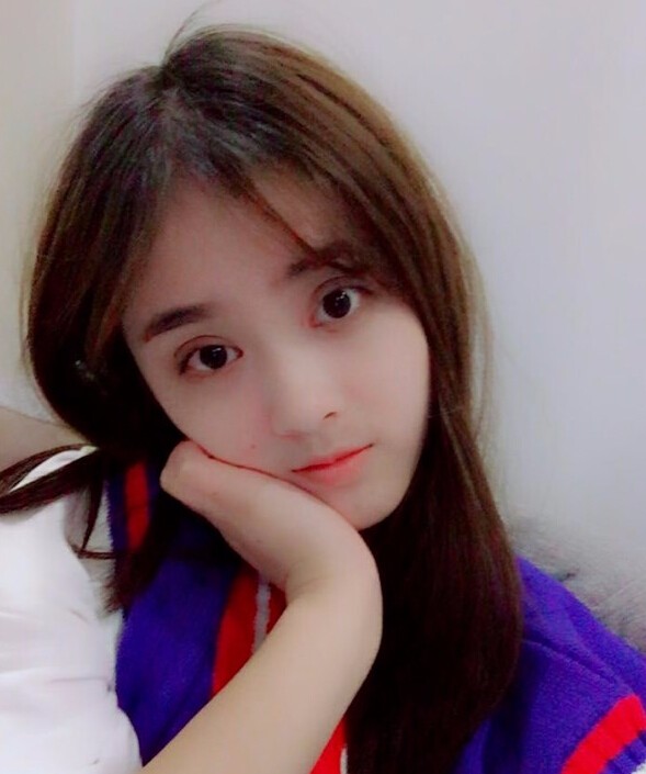 福州愛美爾整形黃林勝雙眼皮案例效果對(duì)比圖