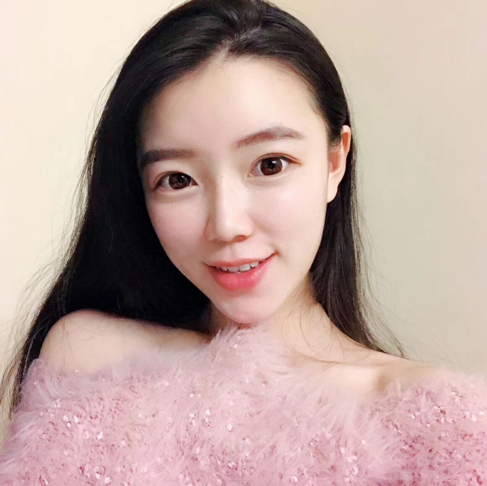 山西伊特雅整形醫(yī)生王鳳芹自體脂肪豐面頰+V-LINE瓜子臉手術(shù)案例效果圖