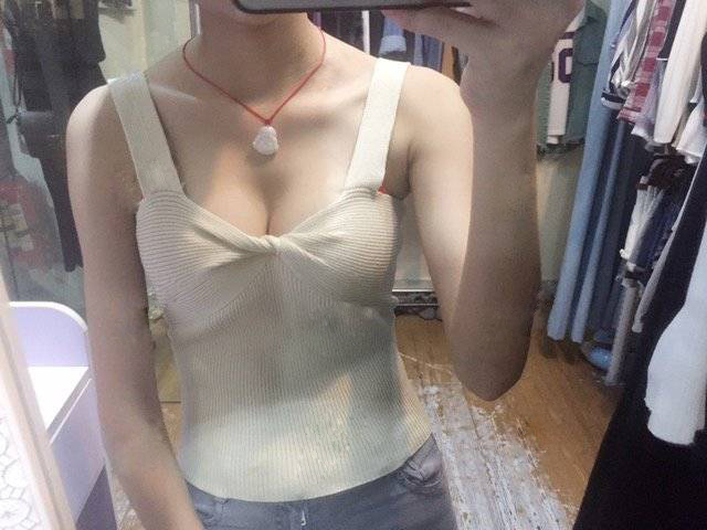 嘉興華山陳榮忠假體隆胸案例