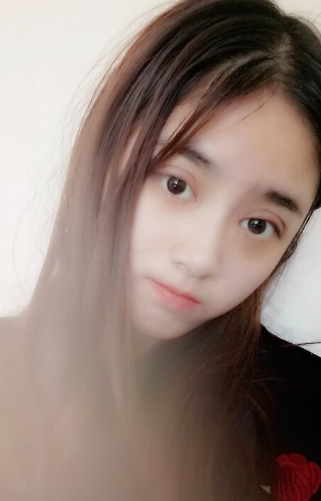 福州愛美爾整形黃林勝雙眼皮案例效果對(duì)比圖