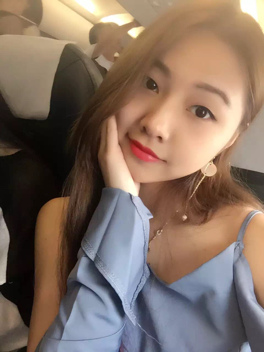 廣州中科美整形醫(yī)生徐長亮做切開雙眼皮怎么樣？附切開雙眼皮案例