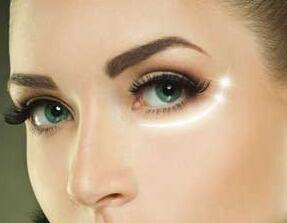 西安藝星醫(yī)療整形美容醫(yī)院激光去黑眼圈