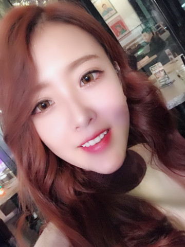 成都漢密爾頓牙齒矯正案例