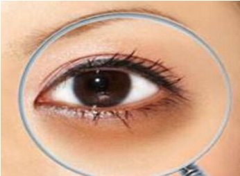 鄭州都市風(fēng)韻醫(yī)療美容門(mén)診部激光去黑眼圈