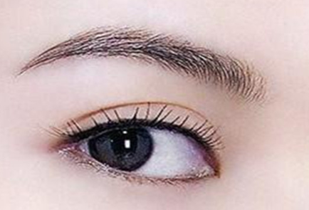 遵義醫(yī)學院附院雙眼皮修復