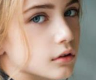 珠海愛思特醫(yī)療美容醫(yī)院雙眼皮修復