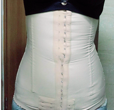 深圳晨曦整形醫(yī)院吉米斯做腰腹吸脂怎么樣？附吉米斯醫(yī)生腰腹吸脂案例