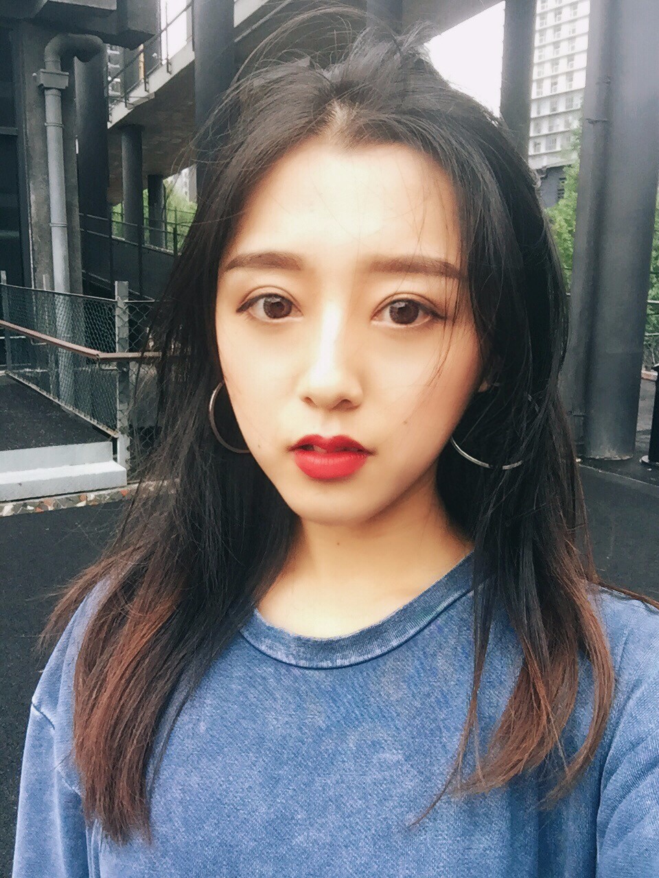 西安米蘭柏羽整形醫(yī)院李旭平做切開雙眼皮效果怎么樣？附案例