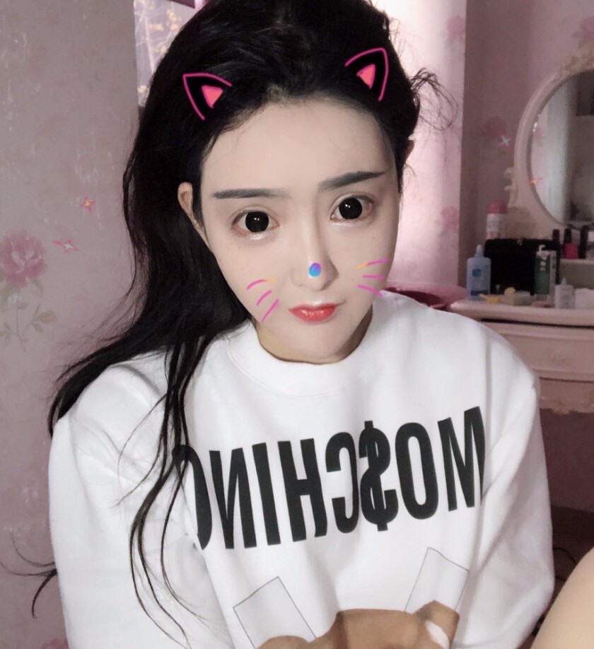 重慶柏漫醫(yī)療美容診所高紅艷醫(yī)生做面部吸脂怎么樣？面部吸脂案例分享