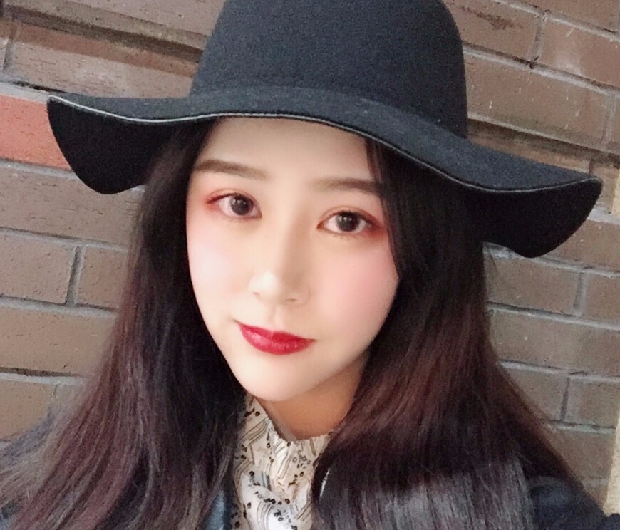 趙煜楠醫(yī)生硅膠墊下巴真人案例