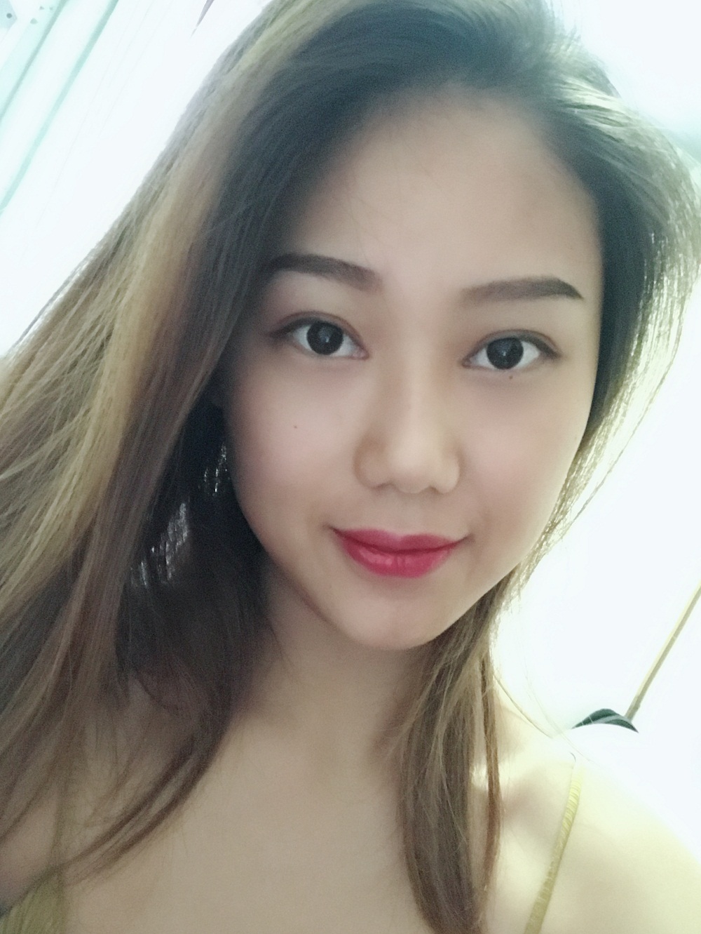 西安藝星埋線提升案例