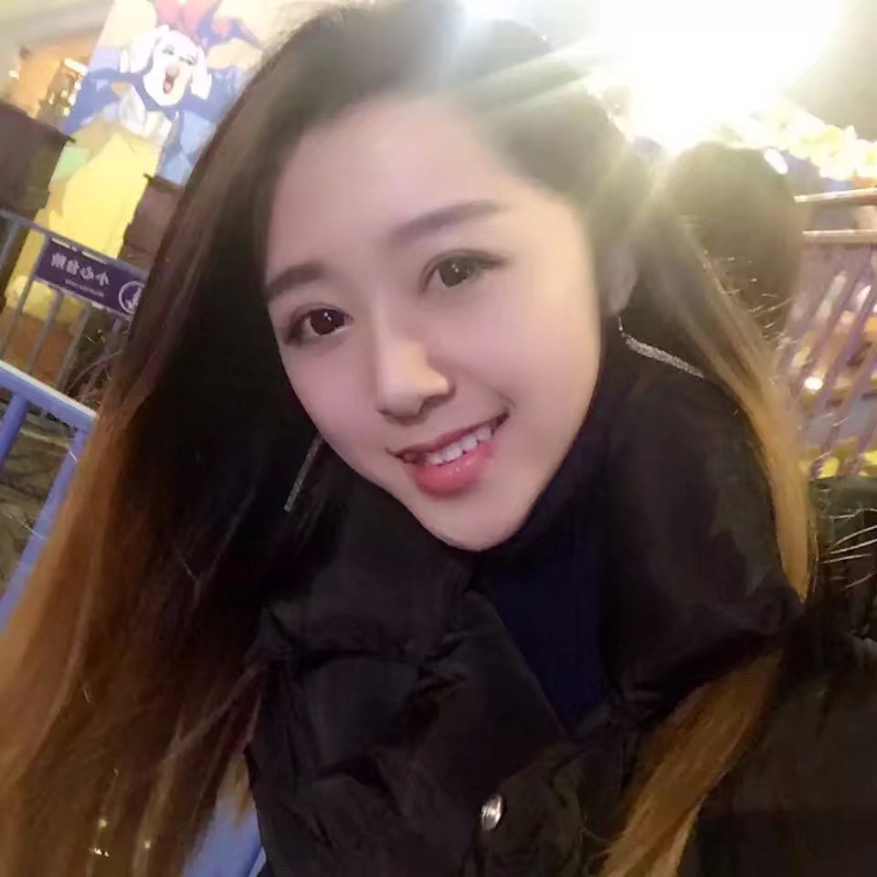 西安米蘭柏羽整形醫(yī)院李旭平做切開雙眼皮效果怎么樣？附案例