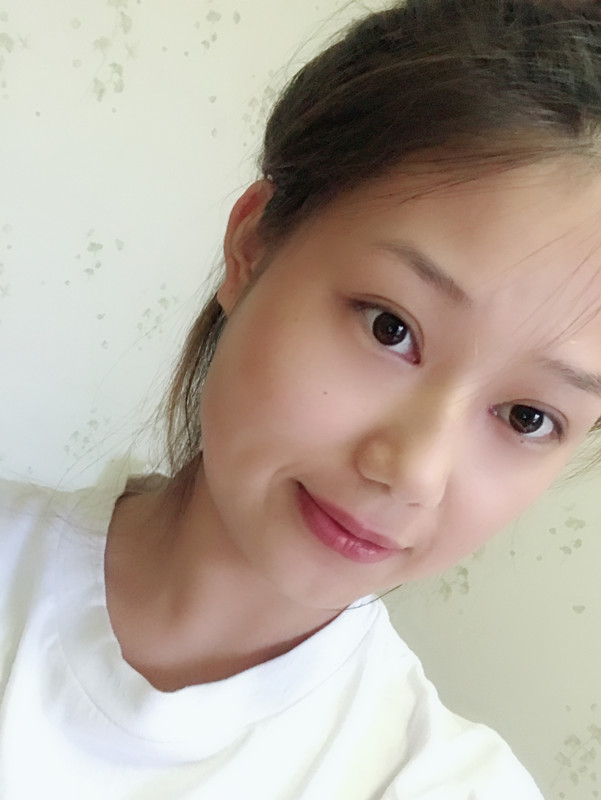 西安藝星埋線提升案例