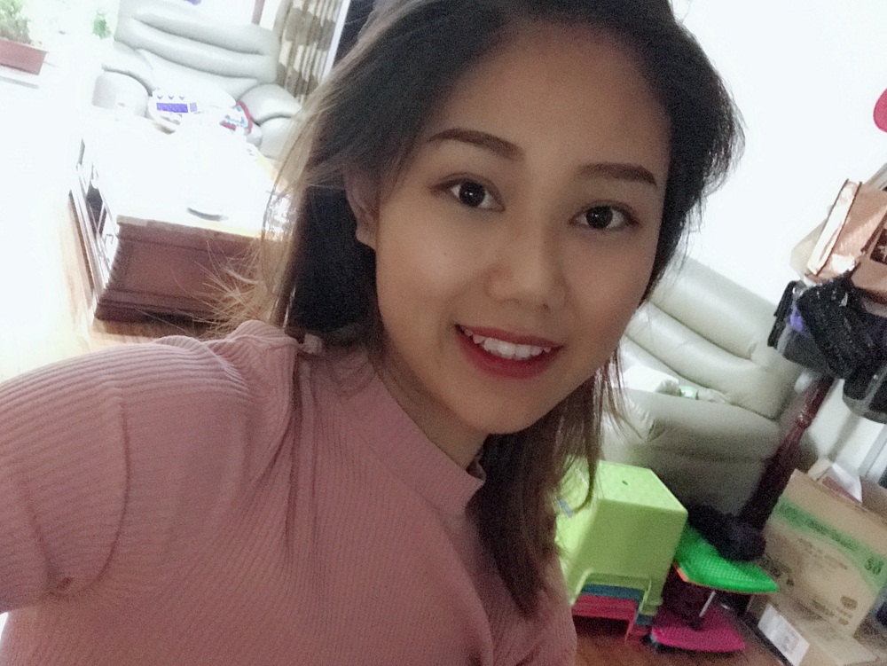 西安藝星埋線提升案例