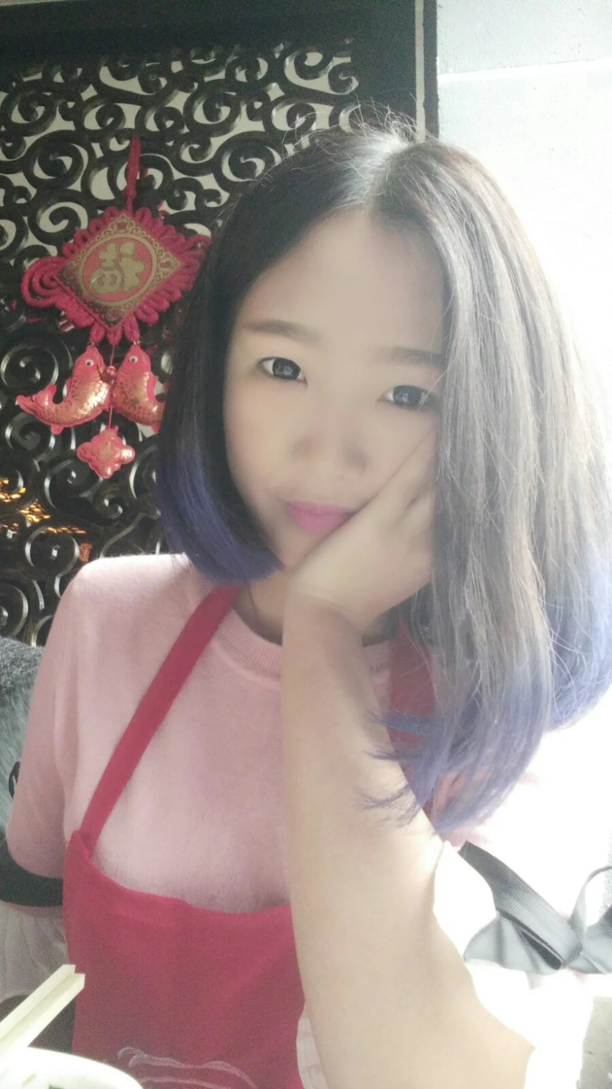 西安米蘭柏羽整形醫(yī)院李旭平做切開雙眼皮效果怎么樣？附案例