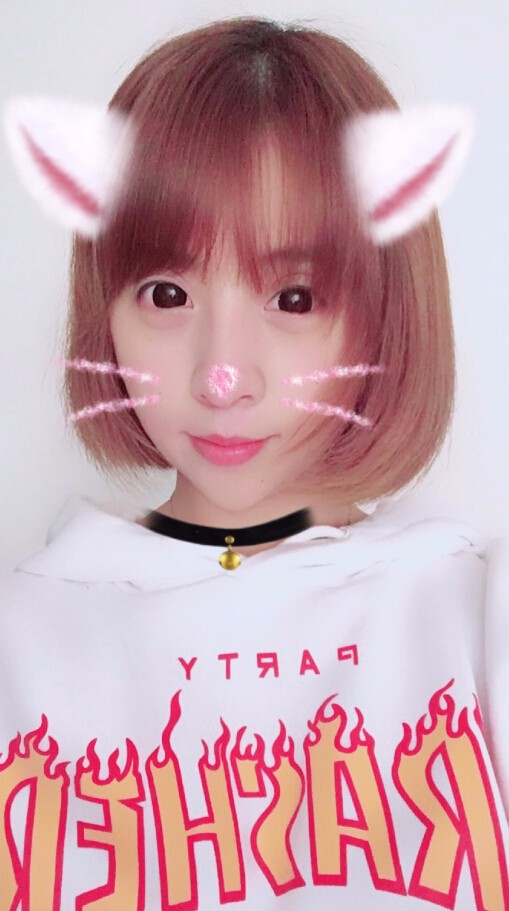 成都晶都醫(yī)療美容醫(yī)院王教授做自體脂肪填充+大腿吸脂+假體隆胸案例分享