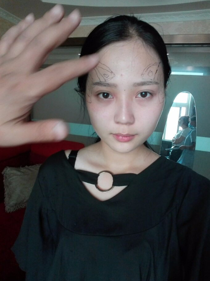 西安華仁醫(yī)院整形美容中心做自體脂肪填充效果怎么樣？附耿延鵬整形案例