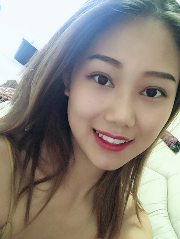 西安藝星埋線提升案例