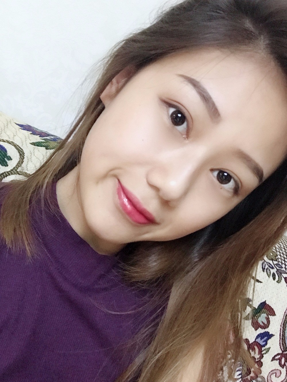 西安藝星埋線提升案例