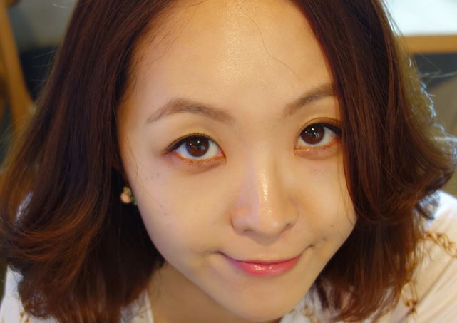 徐州時(shí)光洪揚(yáng)醫(yī)療美容診所宮昔愿醫(yī)生做激光祛斑效果怎么樣？