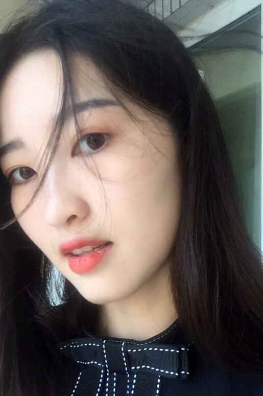 鄭州正合口腔門診部做牙齒矯正怎么樣？附郭毅醫(yī)生牙齒金屬托槽矯正案例