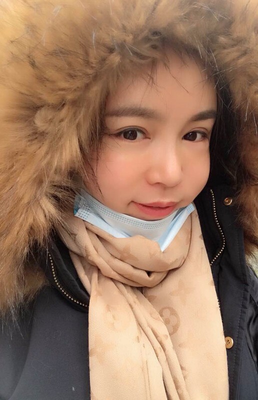 重慶聯(lián)合麗格美容醫(yī)院林麗蓉醫(yī)生做自體脂肪豐蘋果肌怎么樣？附案例