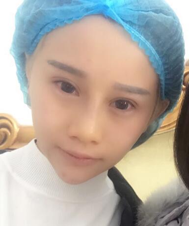 長春奧拉克美容醫(yī)院金相勛醫(yī)生做玻尿酸豐臥蠶怎么樣？附案例