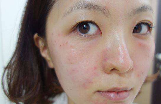 徐州時(shí)光洪揚(yáng)醫(yī)療美容診所宮昔愿醫(yī)生做激光祛斑效果怎么樣？