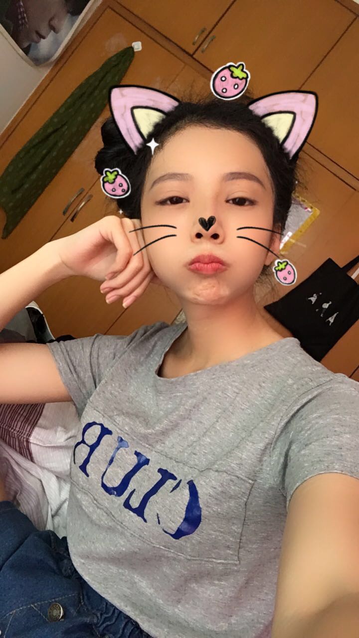 西安高一生醫(yī)療美容醫(yī)院網(wǎng)購恒醫(yī)生做自體脂肪全臉填充案例效果對比圖 西安高一生醫(yī)療美容醫(yī)院網(wǎng)購恒醫(yī)生做自體脂肪全臉填充案例效果對比圖