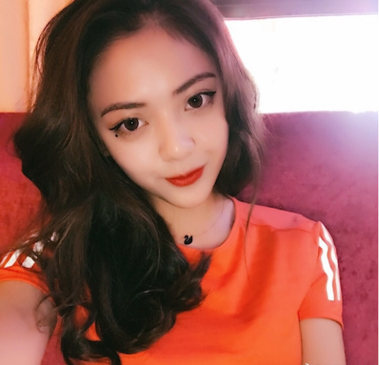 珠海平安康復醫(yī)院整形美容中心查元坤醫(yī)生面部吸脂案例效果對比圖