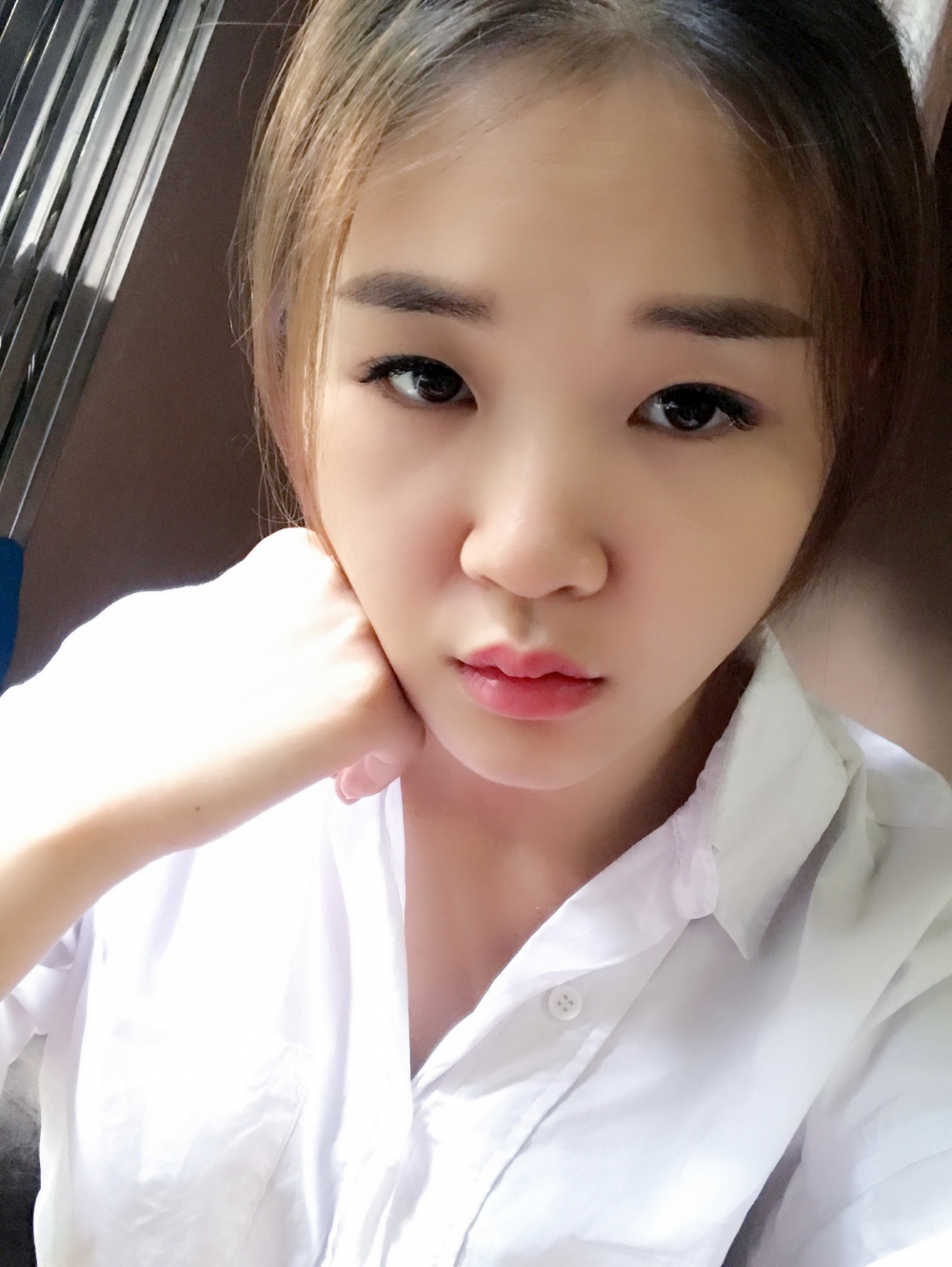 鄭州華領(lǐng)醫(yī)療美容醫(yī)院賀小虎醫(yī)生做眼綜合+鼻部整形手術(shù)效果怎么樣？