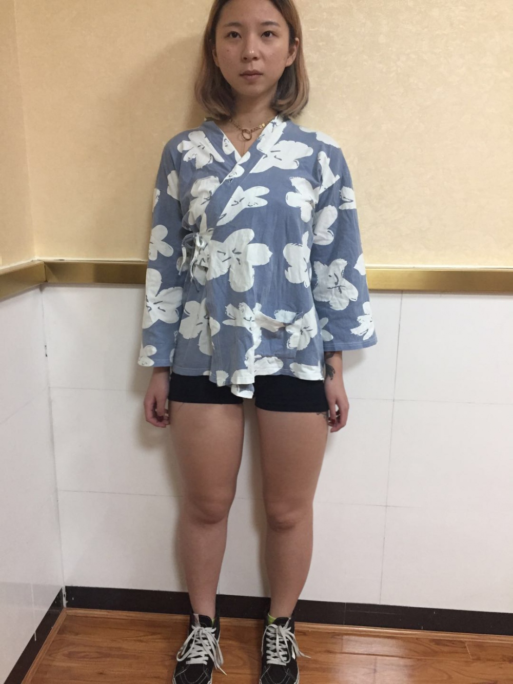 深圳鵬愛醫(yī)療整形醫(yī)生張建文做大腿吸脂怎么樣？附大腿吸脂案例效果對比圖