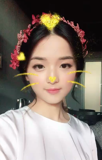 鄭州名門整形醫(yī)院董斌醫(yī)生做下頜角整形怎么樣？附下頜角整形案例