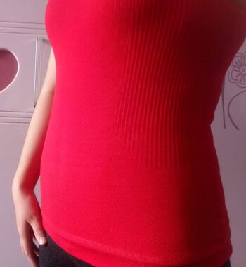 武漢東方麗人醫(yī)院整形美容科胡江偉醫(yī)生做腰腹吸脂案例效果對比圖 武漢東方麗人醫(yī)院整形美容科胡江偉醫(yī)生做腰腹吸脂案例效果對比圖