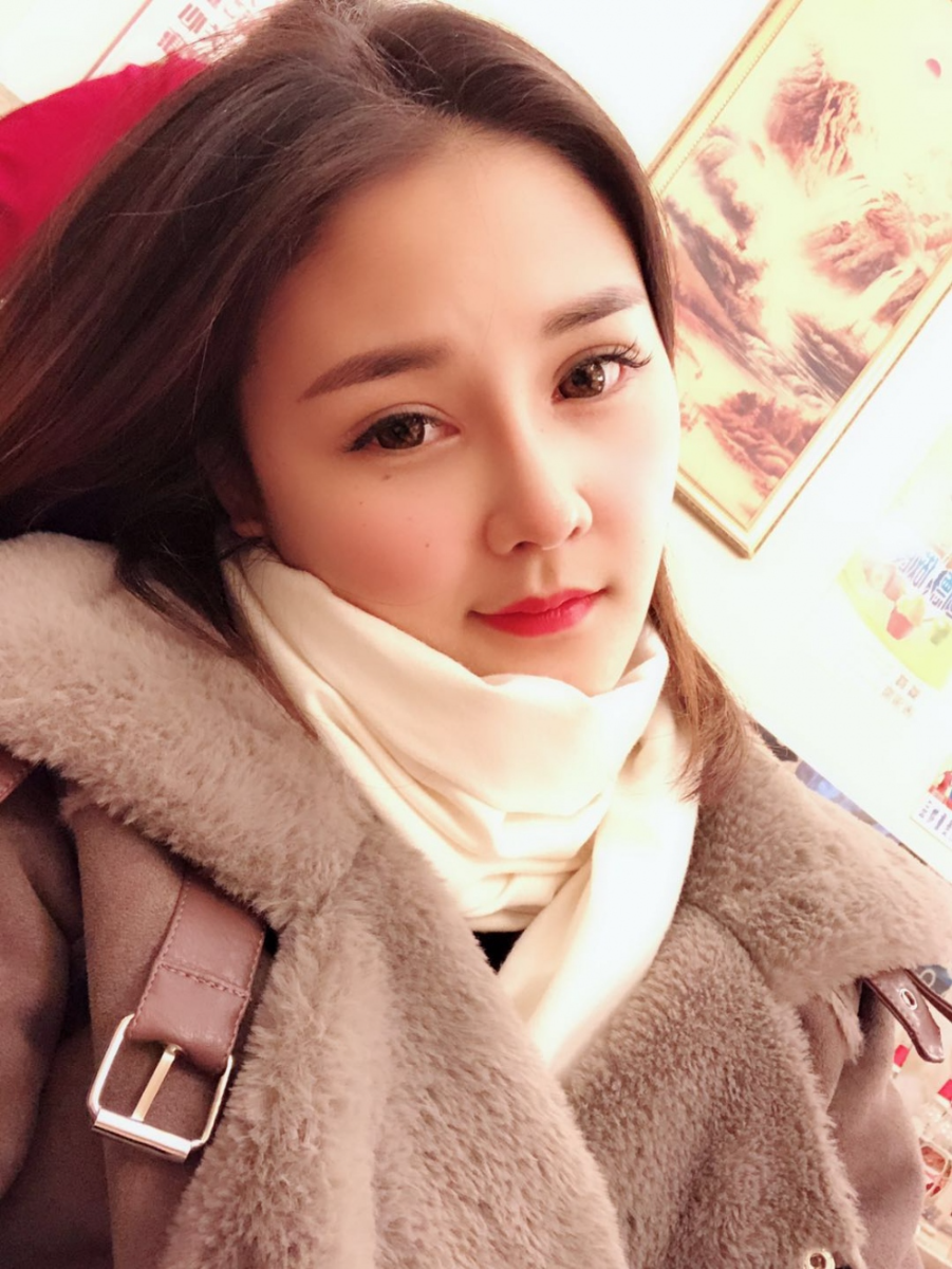 鄭州華領醫(yī)療美容醫(yī)院賀小虎醫(yī)生做眼綜合+鼻部整形手術效果怎么樣？