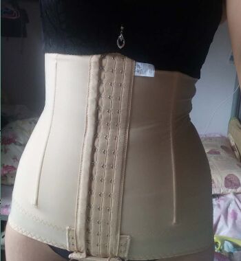 武漢東方麗人醫(yī)院整形美容科胡江偉醫(yī)生做腰腹吸脂案例效果對比圖 武漢東方麗人醫(yī)院整形美容科胡江偉醫(yī)生做腰腹吸脂案例效果對比圖