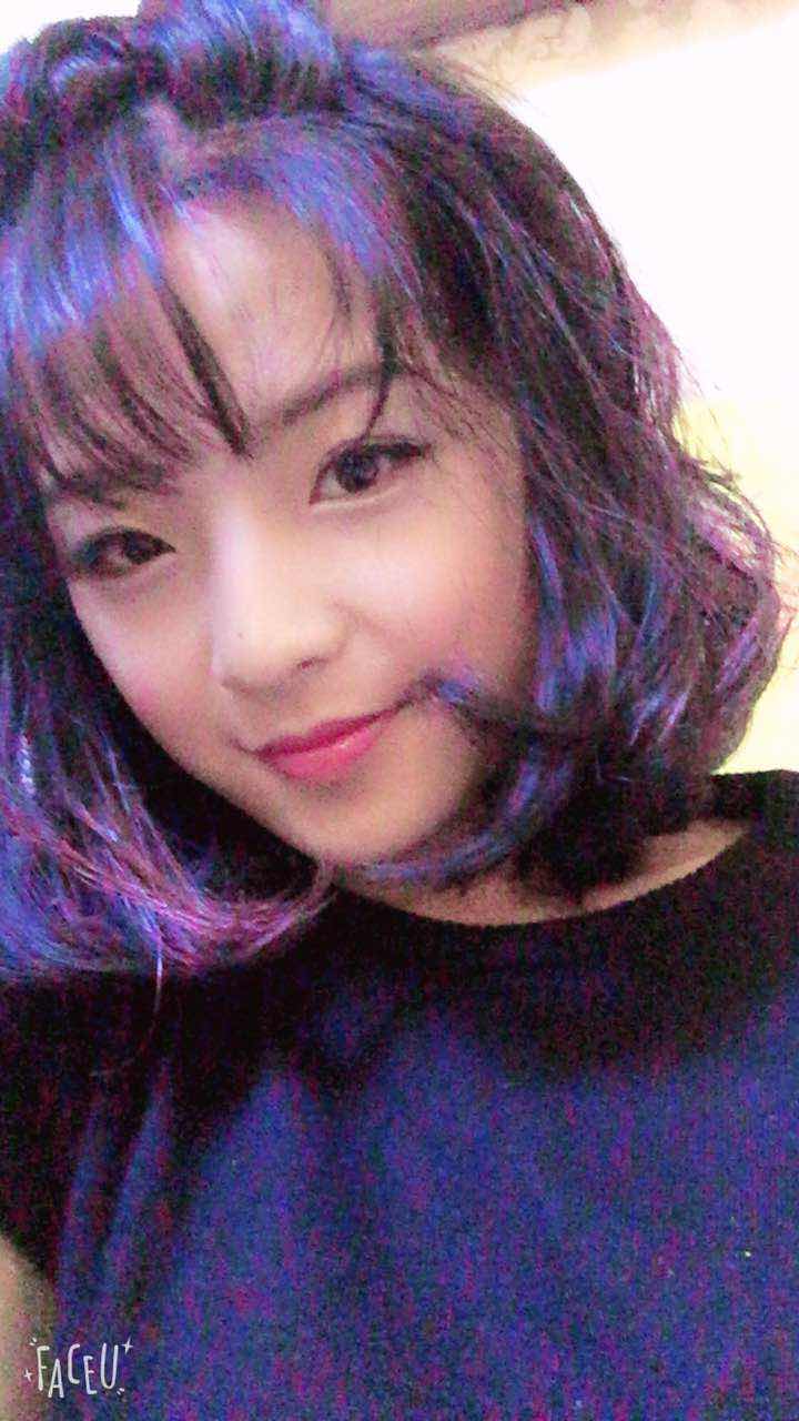 鄭州名門整形醫(yī)院董斌醫(yī)生做下頜角整形怎么樣？附下頜角整形案例