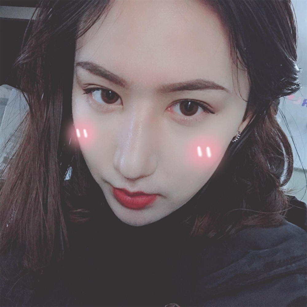 煙臺(tái)洛神醫(yī)學(xué)美容醫(yī)院張瑞允醫(yī)生做硅膠隆鼻怎么樣？附硅膠隆鼻案例