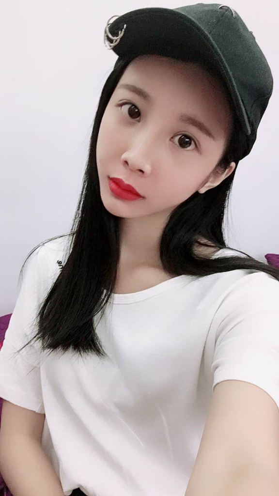 西安高一生醫(yī)療美容醫(yī)院網(wǎng)購恒醫(yī)生做自體脂肪全臉填充案例效果對比圖 西安高一生醫(yī)療美容醫(yī)院網(wǎng)購恒醫(yī)生做自體脂肪全臉填充案例效果對比圖