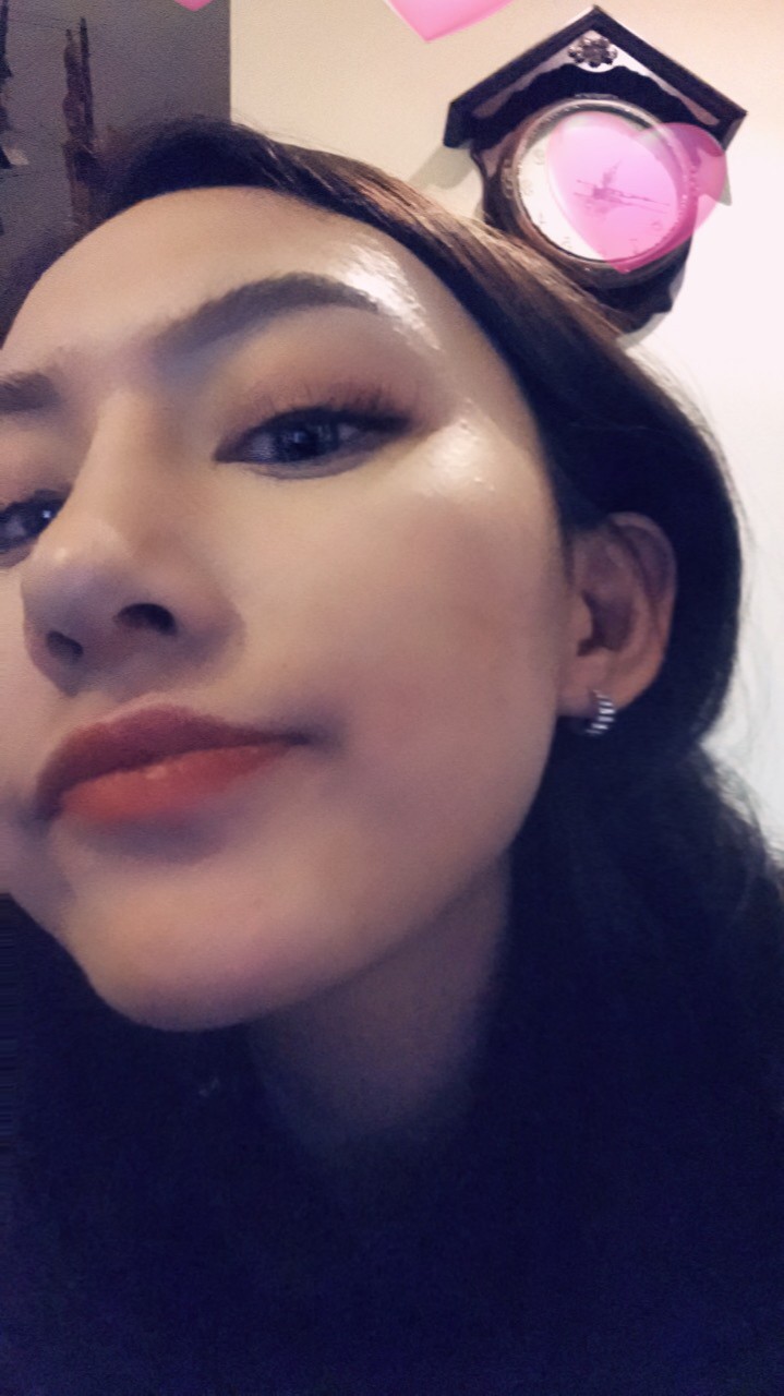 煙臺(tái)洛神醫(yī)學(xué)美容醫(yī)院張瑞允醫(yī)生做硅膠隆鼻怎么樣？附硅膠隆鼻案例