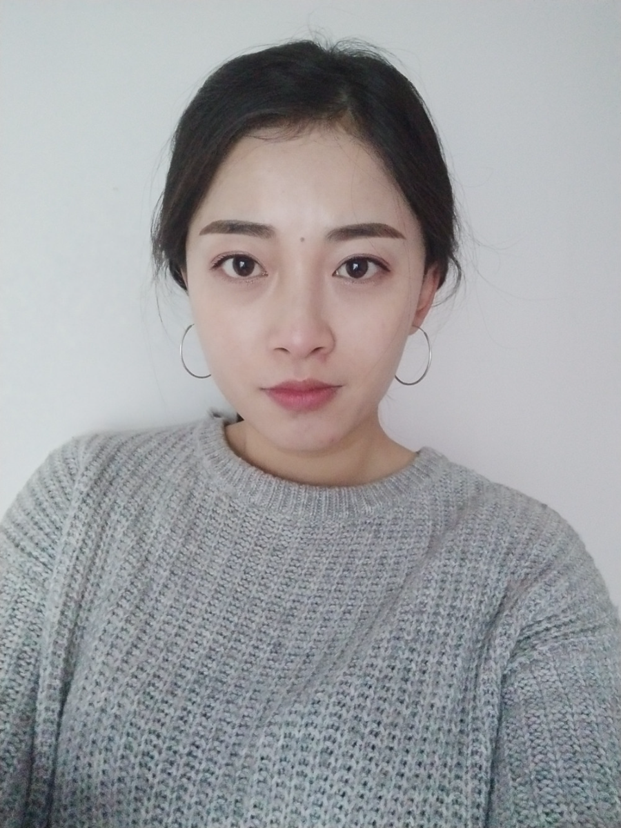 重慶當(dāng)代整形李敏旭醫(yī)生做皮秒激光祛斑效果怎么樣？附皮秒激光祛斑案例