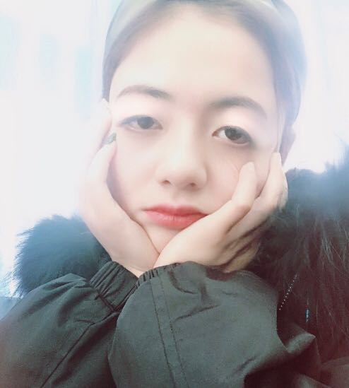 珠海平安康復醫(yī)院整形美容中心查元坤醫(yī)生面部吸脂案例效果對比圖