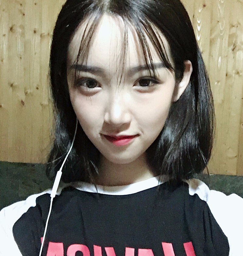 重慶威妮醫(yī)療整形醫(yī)生伊莉做切開雙眼皮+開眼角真人案例效果對(duì)比圖 重慶威妮醫(yī)療整形醫(yī)生伊莉做切開雙眼皮+開眼角真人案例效果對(duì)比圖