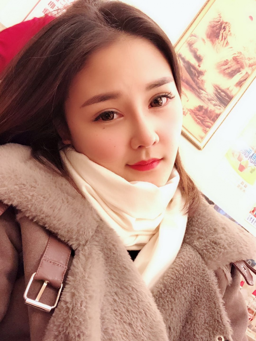 鄭州華領(lǐng)醫(yī)療美容醫(yī)院賀小虎醫(yī)生做眼綜合+鼻部整形手術(shù)效果怎么樣？